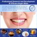 28 Tooth Whitening Strips - Effective Stain Removal & Enamel Safe Mint Taste | Fast Teeth Bleaching for a Bright Smile - Buy Online on GoSupps.com