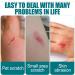 KOAHDE Gel Liquid Bandage 10ML - Breathable & Waterproof Wound Care for Minor Cuts - Buy Online on GoSupps.com