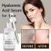 Hyaluronic Acid 2%+B5 Hyaluronic Acid Serum Acid Serum Anti Aging Facial Brightening Serum Hyaluronic Acid for Face Hydrated Hyaluronic Acid Serum for Hydrated Hydraulic Acid Serum - Buy Online on GoSupps.com