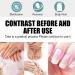 Keratin Nail Growth Oil Keratin 3 Day Growth Nail Treatment & Strengthener Nail Growth Treatment Nail Repair Treatment Nail Strengthener for Damaged Nails Strengthening Nail Polish - Buy Online on GoSupps.com
