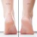 2 Pair Danielle Creations Moisturizing Foot Mask - Lavender - Buy Online on GoSupps.com
