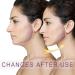 V-Line Mask Double Chin Reducer - Jawline Shaping Strap for Women | Sleep Slimming Face Lifting Tape & Jaw Exerciser - Buy Online on GoSupps.com