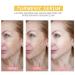 2023 New Turmeric Dark Spot Corrector Serum for Hyperpigmentation & Age Spots - Skin Care Moisturizing Repair Essence for Men & Women - Buy Online on GoSupps.com