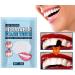 Suphyee Formable False Teeth Repair Set | Provisional Denture Kit for Missing Teeth - Self-Confident Smile with Thermal Adaptation Beads - Buy Online on GoSupps.com