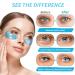 Under Eye Patches for Puffy Eyes - 24 Pairs Retinol Collagen Gel Pads Anti-Aging Eye Masks for Wrinkle Reduction & Moisturizing - Fast International Shipping - Buy Online on GoSupps.com