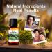 Kukka Cypress Essential Oil - 100% Natural Grade for Aromatherapy - Varicose Veins & Diffuser - 10 ml - Buy Online on GoSupps.com