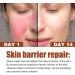 Rosacea Face Serum Face Serum Hyaluronic Acid Face Oil Anti-Aging Relieve Redness &Quick Repair Damage Skin Niacinamide Serum Replumps & Hydrates Collagen Face Serum-Protect Skin+Reduce Acne-Women 1 - Buy Online on GoSupps.com