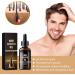 Ginger Hair Growth Oil Hair Growth Serum with Ginseng Hair Regrowth Essence for Thinning Balding Repairs Hair Follicles Moisturize Scalp and Promote Hair Growth Strengthen Hair Root - Buy Online on GoSupps.com