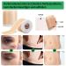 Silicone Scar Sheets - Professional Silicone Paving for Scars 4cm x 150cm Roll Ideal for C-section Burns Keloid & Acne - Medication-Free Solution - Buy Online on GoSupps.com