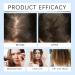  homomdy Rosemary Hair Growth Serum Roll Up Hair Growth Serum Roll-Up Care Serum to Prevent Hair Loss Strengthen and Encourage Thicker Hair for Men and Women Enhances Hair - Buy Online on GoSupps.com