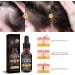 Hair Growth Serum for Black Women Hair Growth Oil New Hair Growth Serum Anti Hair Loss Nourishes Dry and Damaged Hair - Buy Online on GoSupps.com