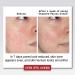 THAYERS Rose Petal Witch Hazel Toner - Alcohol-Free Organic Aloe Vera | International Shipping - Buy Online on GoSupps.com