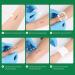 5pcs Zip Stitch Suture Free Wound Closure Strips | Butterfly Bandages for Emergency Laceration Repair - First Aid Kit Essential - Buy Online on GoSupps.com