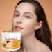Fizepgo Spots Removal Cream | Bee Venoms Repair Cream | Mild Anti-Age Hydrating Moisturizing Cream | Bee Venoms Skin Tag Remover - Hydrating Moisturizing Cream For All Skin - Buy Online on GoSupps.com