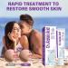 Buy Azelaic Acid Cream & 12% Serum - Skin Hyaluronic Acid & Niacinamide for Redness Relief - Fast International Shipping - Buy Online on GoSupps.com