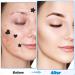 Sibba Face Pimple Patches - 180pcs Cute Hydrocolloid Star & Heart Shaped Spot Stickers for Pore Cleaning & Zit Absorption - Buy Online on GoSupps.com