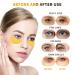 24K Gold Under Eye Patches w/Serum - 18 Pairs for Dark Circles & Puffiness | Eye Gel Pads w/Caffeine & Vitamins for Under Eye Bags Treatment - Buy Online on GoSupps.com