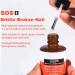 Broken & Brittle Nail Treatment - Multi-purpose Nail Strengthener - Strengthening Hardening Conditioner - Extreme Strength Nail Serum - Quick Help for Split Brittle and damaged Nails 15ML - Buy Online on GoSupps.com