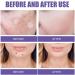 Dark Spots Patches Safe Invisible Patch Portable Patch Remover Dissolving Spots Pimple Patch Smooth Spots Remover Patch Facial Acting Patch for Body Face Skin Dots Spots - Buy Online on GoSupps.com