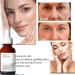 Face Moisturiser - Soothing & Barrier Support Serum Barrier Serum Skin Barrier Repair Cream Tightening Serum Serum Face Anti Redness Serum Facial Serum Face Moisturiser Serum Face Skincare Serum - Buy Online on GoSupps.com