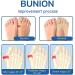 Orthoes Bunion Relief Socks - Projoint Antibunions Health Sock | Compression Anti Bunion Toe Alignment Socks (5 Pairs) - Buy Online on GoSupps.com