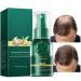 Joyivike 2 Hair Oil Mist, Ginger Oil 30ML, Hair Oil Mist Grows Hair Thicker, Longer, Accelerates Hair Growth for Men