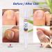 Treatonic Extra Strength Toe Nail Fungus Treatment - Fast Acting Cure for Toenail Fungus - 4 Count Pack - Buy Online on GoSupps.com