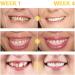 7 Day Active Gum Treatment Antibacterial Gum Treatment Gel Anti-Yellowness Serum for Stain Treatment Gum Treatment Gel Oral Cleaning - Buy Online on GoSupps.com