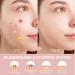 Scettar 272 Invisible Pimple Patches | Hydrocolloid Acne Treatment | Anti-Inflammatory Solution for Clear Skin - Buy Online on GoSupps.com