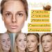 Snail Mucin Essence Snail Mucin Repair Cream Snail Cream Skin Lightening Snail Mucin Face Serum Hydrating Hyaluronic Acid Serum Dark Spot Remover for Face Anti Wrinkle Face Serum for Women Bot - Buy Online on GoSupps.com