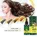 Ginger Hair Growth Serum - 30ML - Nourishing Hair Roots - Regrow 7 Days - 1 Fl Oz - Buy Online on GoSupps.com