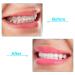 10 White Aligner Chewies Trays - Original Scent Dental Chewies - Buy Online on GoSupps.com