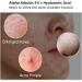 60ML Alpha Arbutin 2% + Hyaluronic Acid 2% Alpha Arbutin Serum Dark Spots Removal Hyaluronic Acid Serum Brightening Serum Hydrating Moisturiser Anti-Wrinkle Serum Anti Aging Serum - Buy Online on GoSupps.com