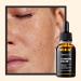 SkinTra Comedo-killer 2% Salicylic Acid Serum - Blemish & Acne Spot Treatment - Exfoliating Serum with Azeloglycine & Gluconolactone - Clogged Pores & Closed Comedone Treatment - 30 ml/Net 1.01 Fl. Oz - Buy Online on GoSupps.com