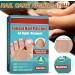 2024 New 3Boxes/48pcs Anti Fungus Nail Treatment Patches Toe Fungus Onychomycosis Repair Sticker Nail Patches - Buy Online on GoSupps.com
