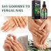 Fungal Nail Treatment Nail Fungus Treatment for Toenail Fungal Nail Treatment for Toenails Extra Strong Protects Thick Broken Discolored Nails Restoring Healthy Nails - Buy Online on GoSupps.com