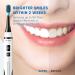 ORAL MASTER Kids Sonic Electric Toothbrush - 5 Modes, 3 Intensity Levels, 2-Minute Timer, Wireless Charge - IPX7 Waterproof - Rocket Series Electric Toothbrush for Child 3+ - Ideal Festival Gift - Buy Online on GoSupps.com