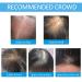 Natural Hair Fibers for Thinning Hair - Instant Thickening Solution for Men & Women - Buy Online on GoSupps.com