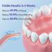 Portable Cordless Water Flosser for Teeth - Ultra Quiet IPX7 Waterproof Oral Irrigator | Rechargeable Dental Care for Travel Home & Office - Buy Online on GoSupps.com