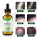 Organic Rosemary Oil for Hair Growth and Skin Care - 60ml | Pure Essential Oil for Hair Loss Treatment - Buy Online on GoSupps.com