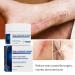 Soothing Scar Removal Cream for Body, Stretch Marks & Tan - Light Blue (One Size) - Buy Online on GoSupps.com