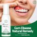 Natural Oral Rinse Spray for Gum Disease & Gingivitis - 50ml Alcohol-Free Treatment with Ginger & Totarol 142 Servings - Buy Online on GoSupps.com