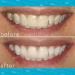 Smileactives Ultramint Teeth Whitening Pen - 0.11oz Gel for White Teeth - Buy Online on GoSupps.com