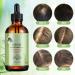 FEXPDL Rosemary Oil For Hair Growth 60ml Organics Rosemary Mint Scalp & Hair Strengthening Oil Rosemary Oil for Hair Growth Hair Growth Oil For Face Hair Care Eyelash & Eyebrow Growth Brown-1 - Buy Online on GoSupps.com