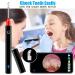 Urbesty Earwax Removal Camera - 1080P HD Wireless Endoscope Kit with Light | Mini Otoscope for Ear Cleaning | Includes Reusable Ear Spoons | Black - Buy Online on GoSupps.com