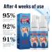 2PCS Toothache Relieving Spray Oral Care Spray Toothache Pain Relief for Adult for Teeth Health Instant Tooth Pain Relief Spray for Toothache Pain Spray for Toothache Relief Sore Gums Treatment - Buy Online on GoSupps.com