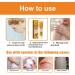 WOSLXM Bee Venom Psoriasis Treatment Cream - Professional Soothing & Moisturizing Formula for All Skin Types (3PCS) - Buy Online on GoSupps.com