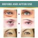 Jasmine Ointment for Dark Circles Active Jasmine Ointment Jasmine Ointment for Drooping Eyelids Active Jasmine Ointment With Collagen And Aloe Vera Jasmine Ointment Plus Jasmine Eye Cream 100ML - Buy Online on GoSupps.com