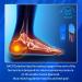 Arch Support Inserts for Heel Spur & Plantar Fasciitis - Pain Relief Orthotics & Gel Insoles for Men & Women - Comfortable Shoe Inserts for Work Boots - Size S (Men 6-7.5/Women 8-9.5 - Buy Online on GoSupps.com