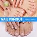 BigyQiu Nail Growth and Repair Serum Onyxoguard Nail Growth and Repair Serum Onyxoguard Nail Growth Serum Nail Repair Serum Nail Strengthener for Damaged Nails Nail Hardener for Growth and Strength - Buy Online on GoSupps.com